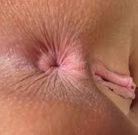 analsex_røvhul_numse-hul